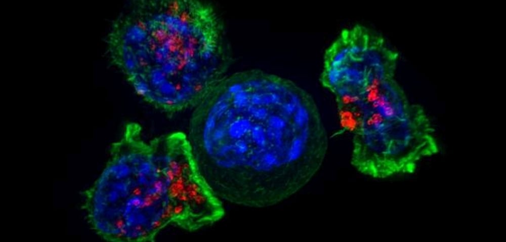 cancer cell surrounded by killer T cells