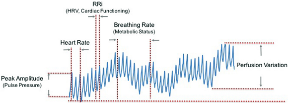 Fig.3: Signal-processing algorithms handle the data coming off wearable sensors.