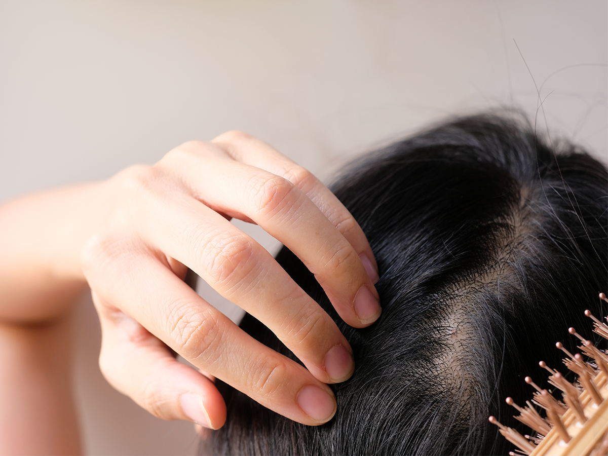 A Trichologist Discusses the Root Causes of An Unhealthy Scalp (And How to  Combat It) | American Salon
