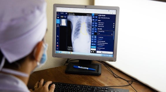doctor looks at chest image on monitor
