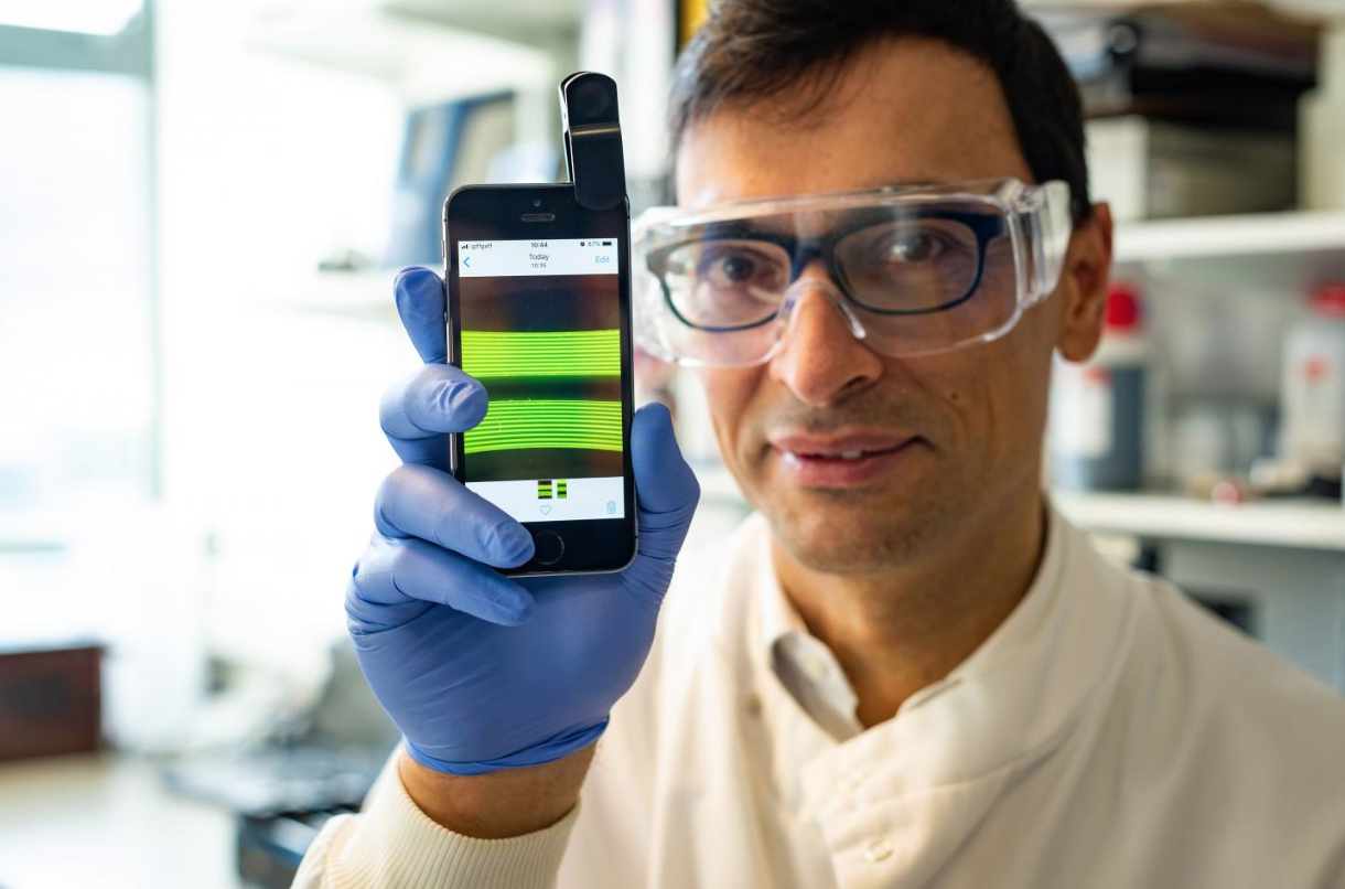 Smartphone cameras speed urinary tract infection diagnosis