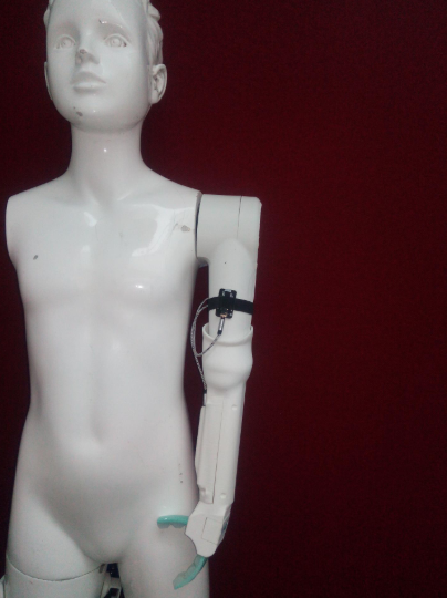 3D prosthetic arm