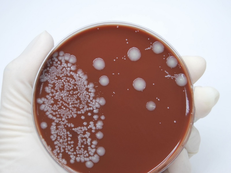 petri dish with orange agar and white bacteria colonies