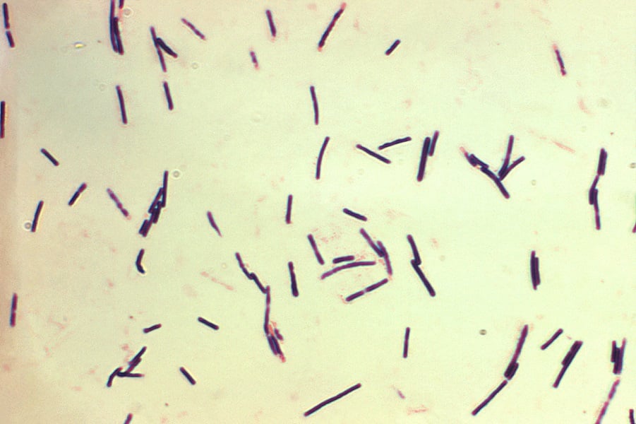 Micrograph of Clostridium perfringens bacteria