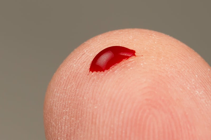 Blood pricked finger