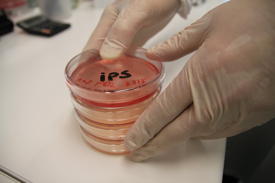 Gloved hands holding Induced pluripotent stem cells in a petri dish
