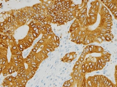 FGFR2 (fibroblast growth factor receptor 2) Gastric tissue at 20x stained on a VENTANA BenchMark XT