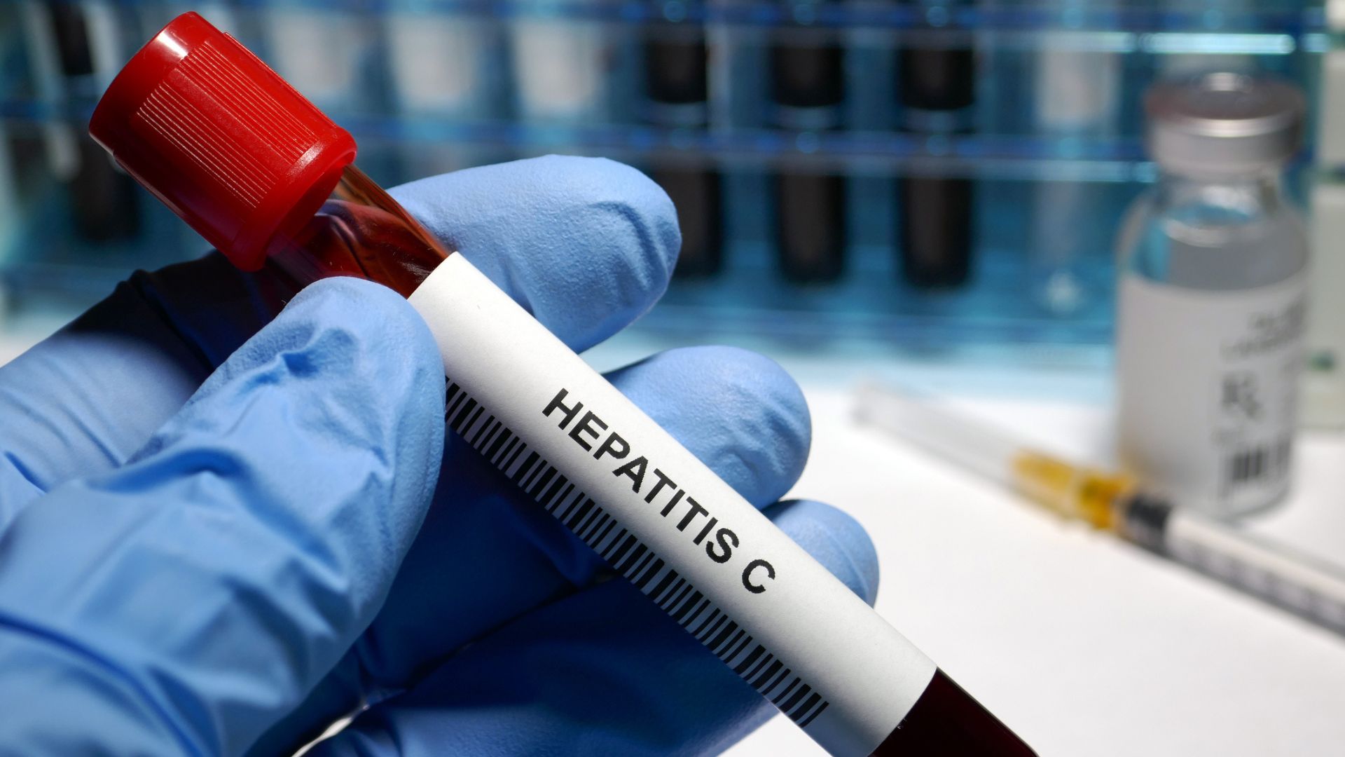 Hepatitis C treatment
