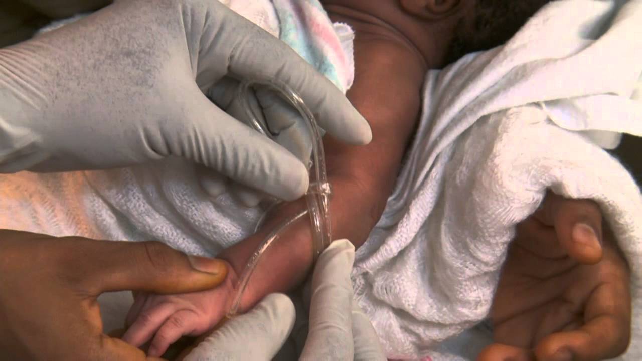 Infant receiving intravenous feeding 