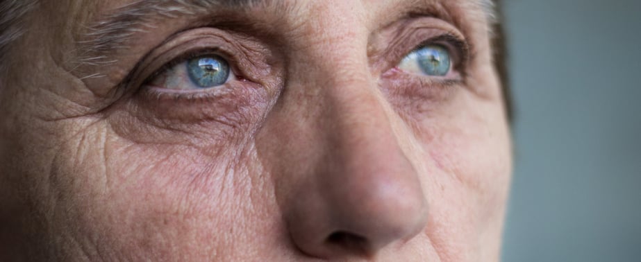An elderly persons face as viewed from the eyes up