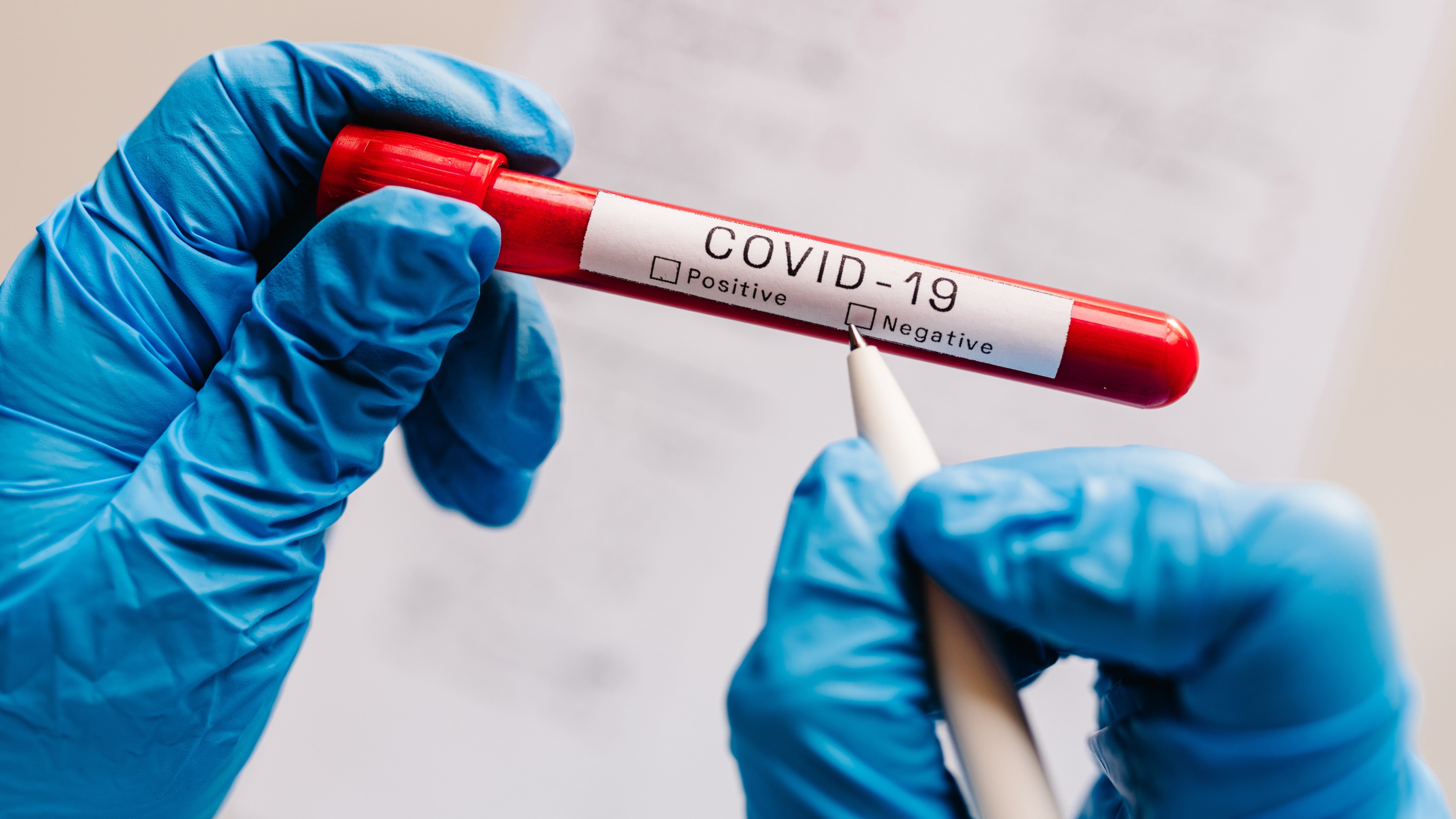 covid test negative test tube COVID-19 pandemic