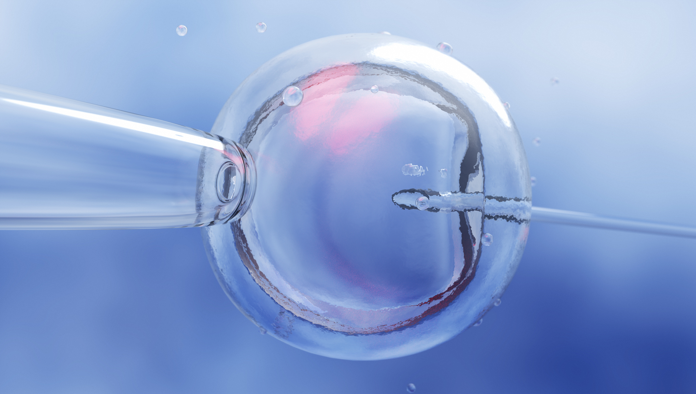 An in vitro fertilization procedure