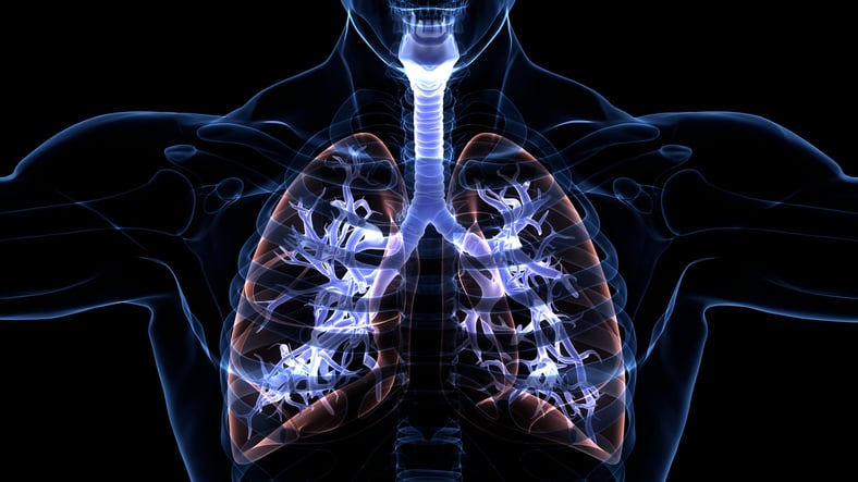 x ray cystic fibrosis 