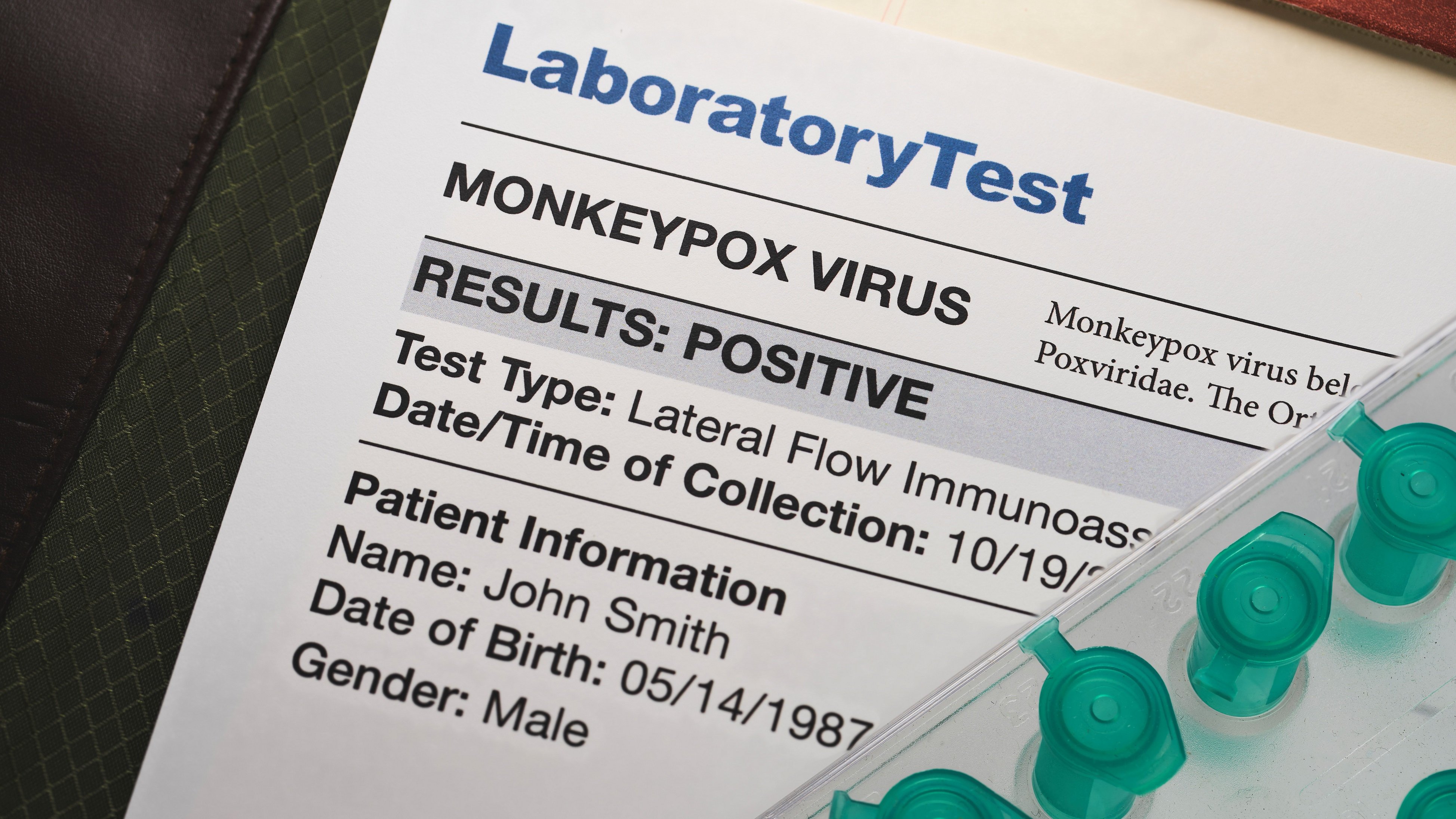Monkeypox laboratory test test results positive