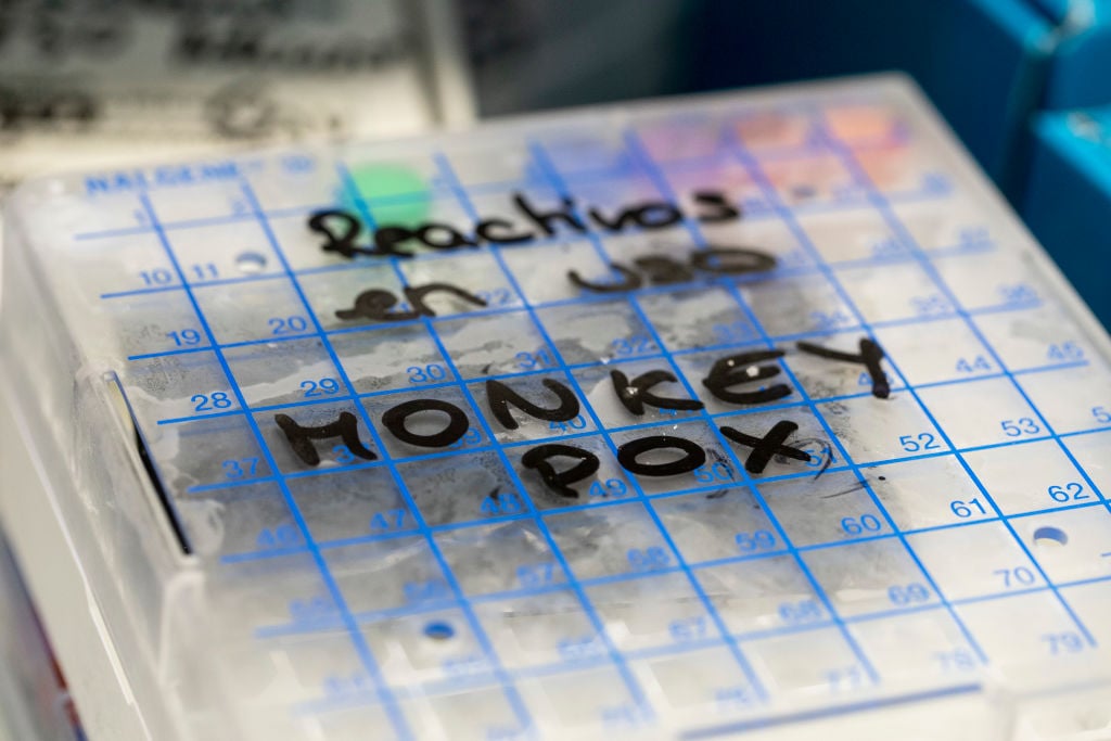 monkeypox test samples