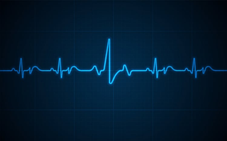 An artists rendering of a normal heart rhythm ECG which glows neon blue against a blue background