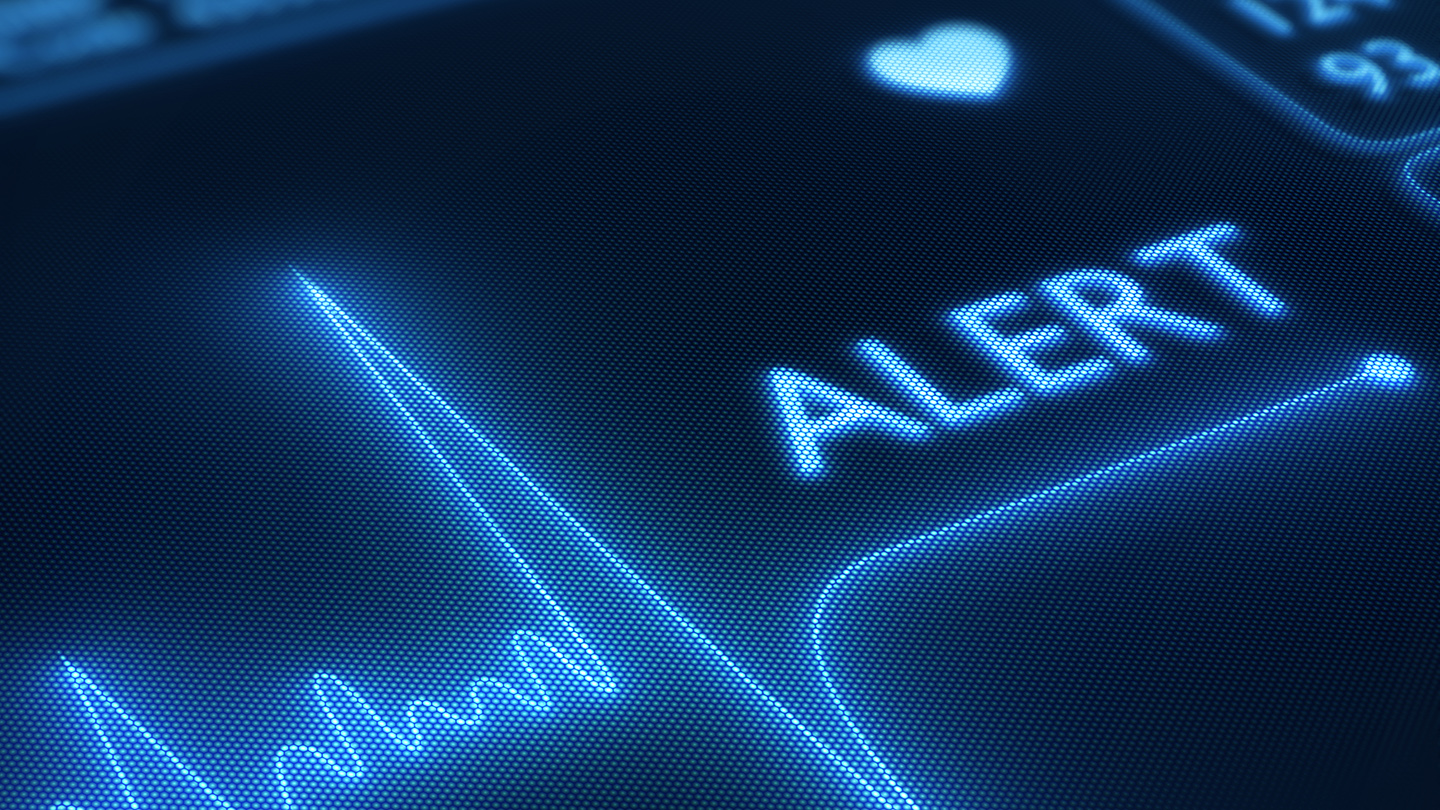 heart disease AKG monitor flatline pulse AFIB
