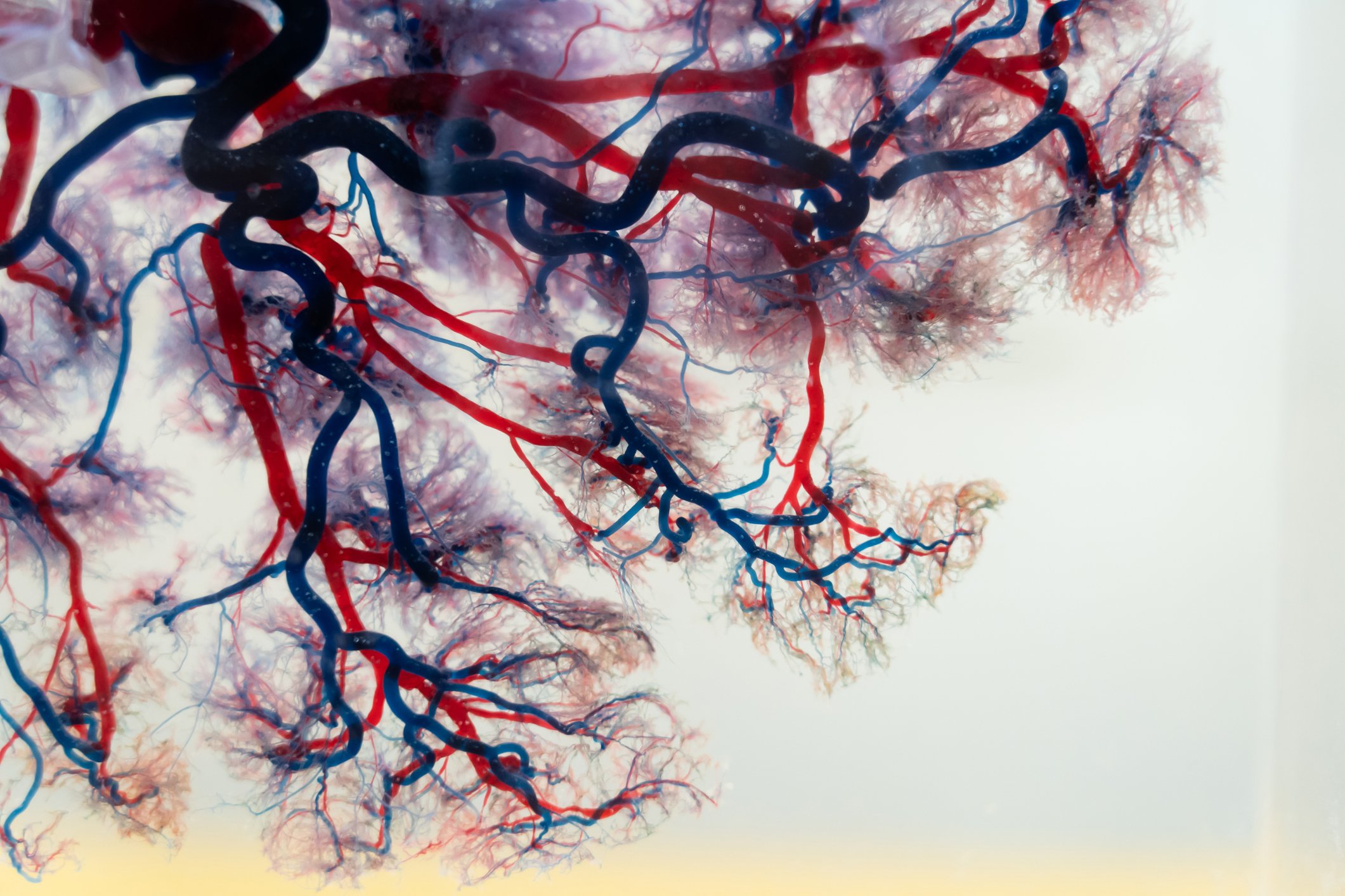 Network of blood vessels against a white background