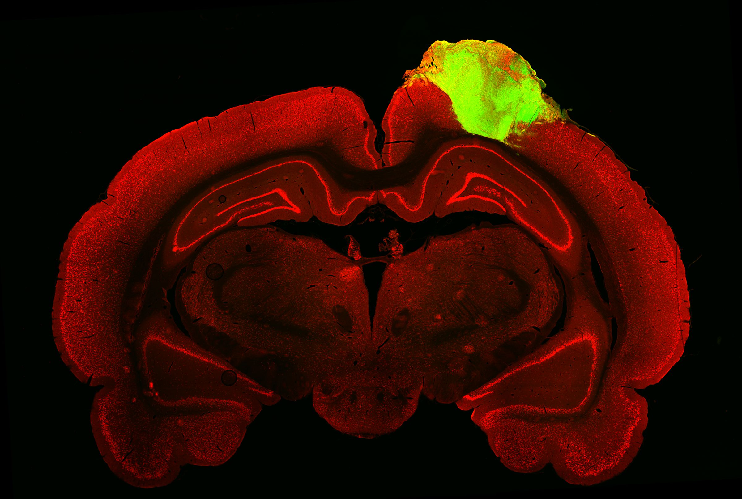 Histological image of a rat brain with a grafted human brain organoid