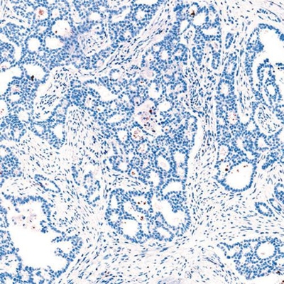 Negative Case of lung tissue stained for ALK