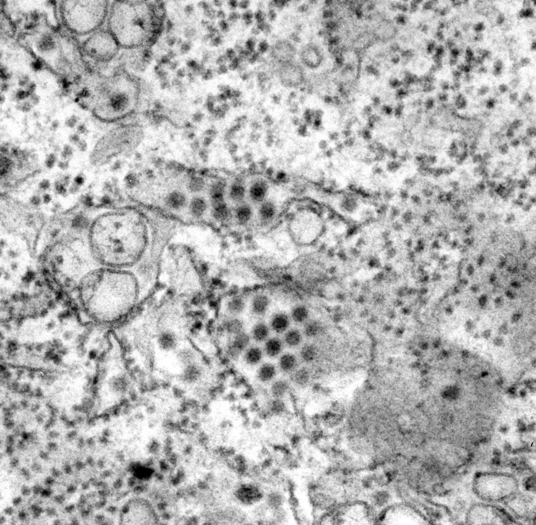 This transmission electron microscopic TEM image depicts a number of round Dengue virus particles that were revealed in th