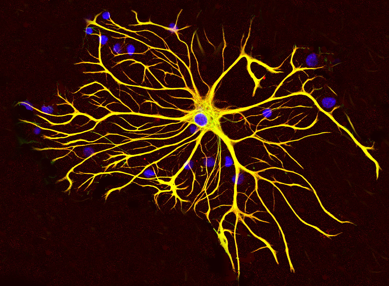 An astrocyte cell grown in tissue culture stained with antibodies to GFAP and vimentin
