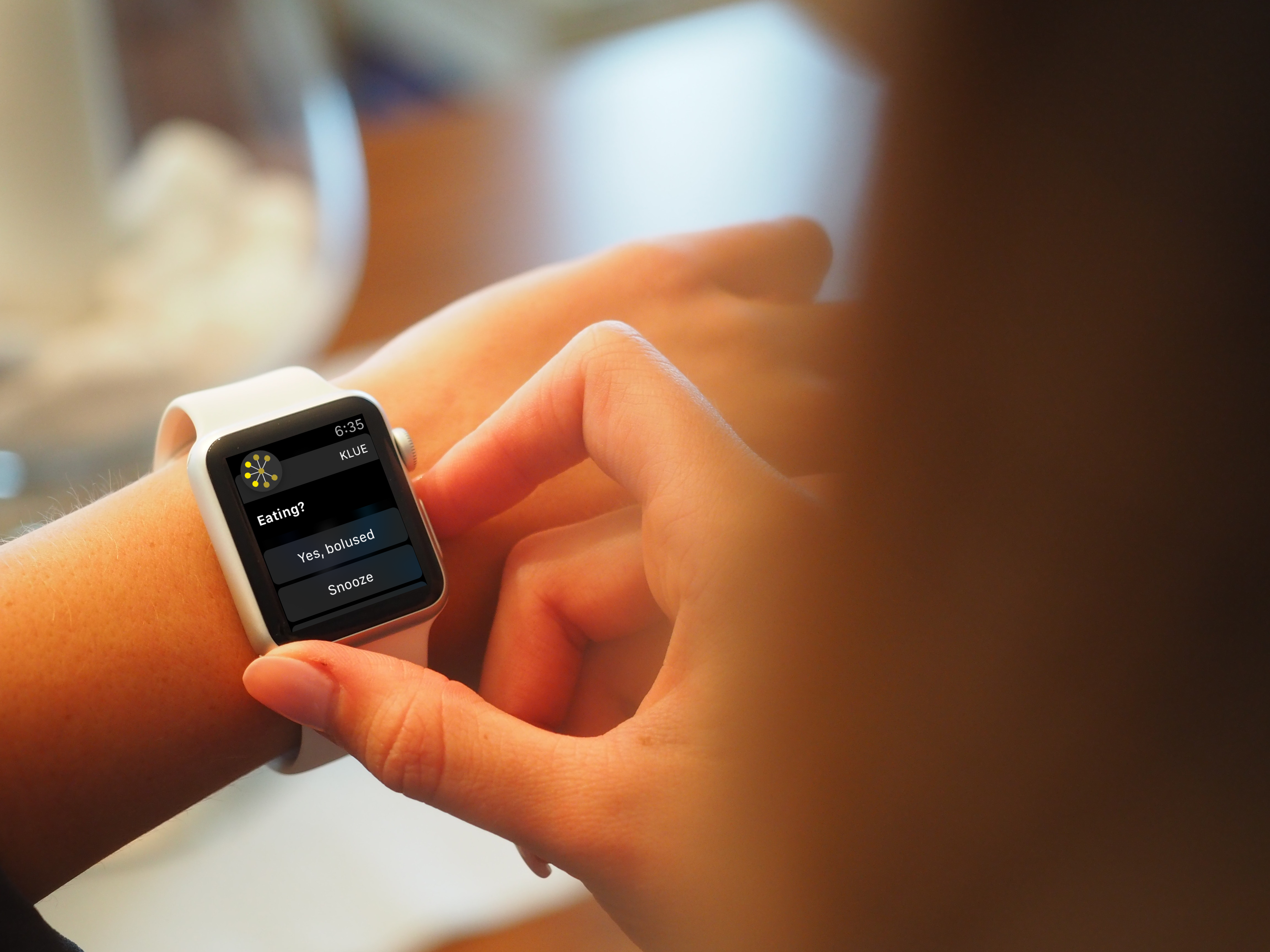 Smartwatch on wrist showing bolus reminder
