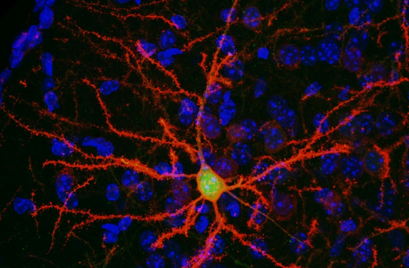 Neuron chemogenetic