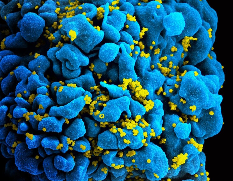 Electromicrograph showing an HIV-infected T cell in blue and yellow