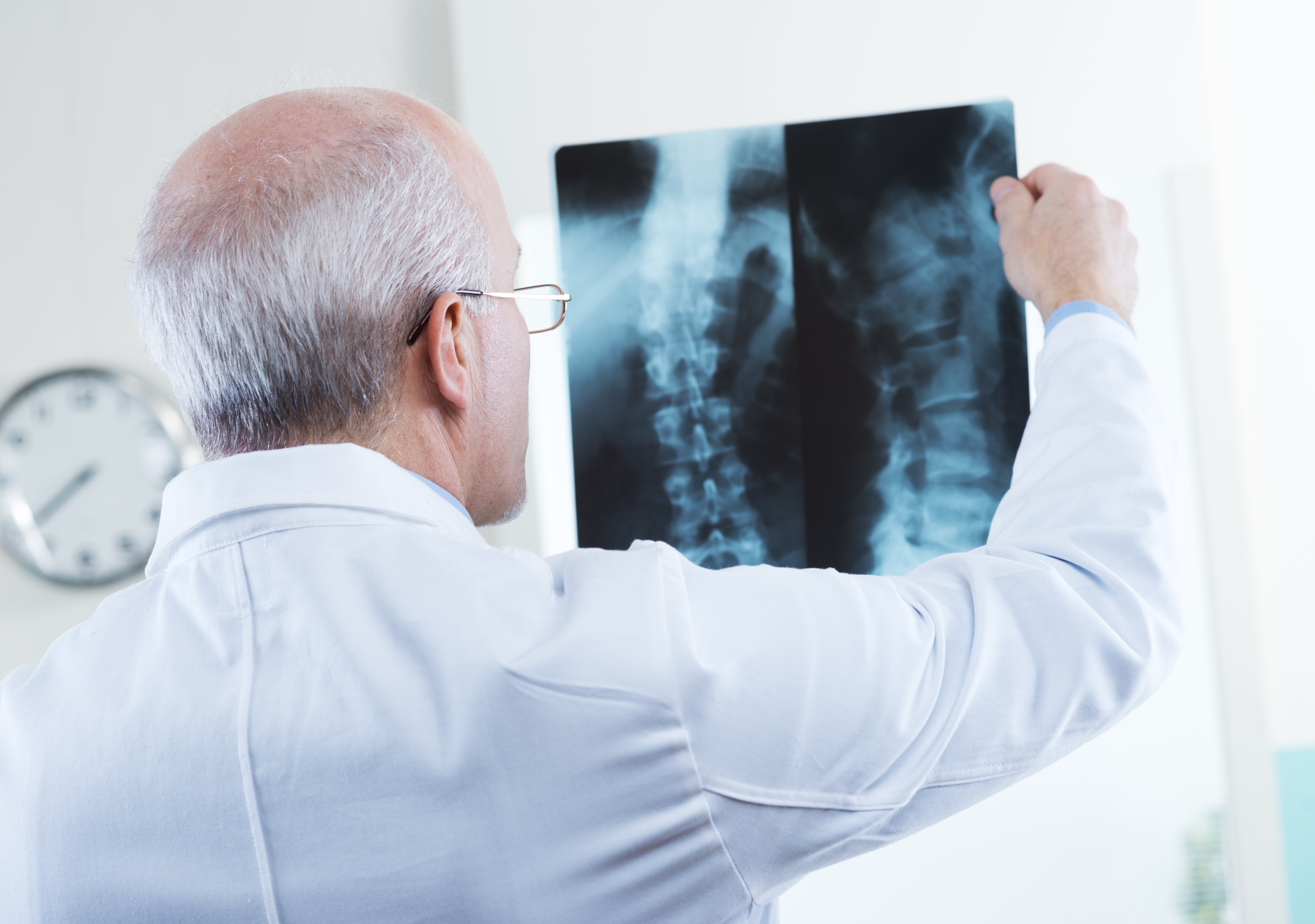 doctor looking at x-ray of spine