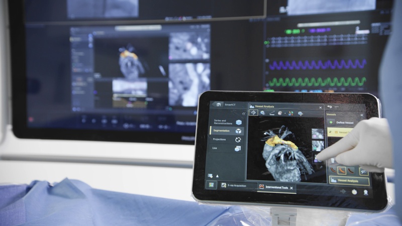 Slink Dependent mimic Philips relaunches its Azurion image-guided therapy platform, with  automated 3D scanning | Fierce Biotech