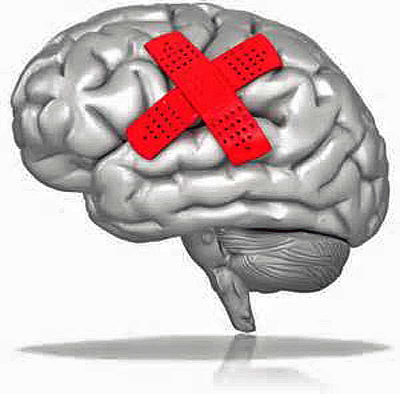 brain injury medical concussion