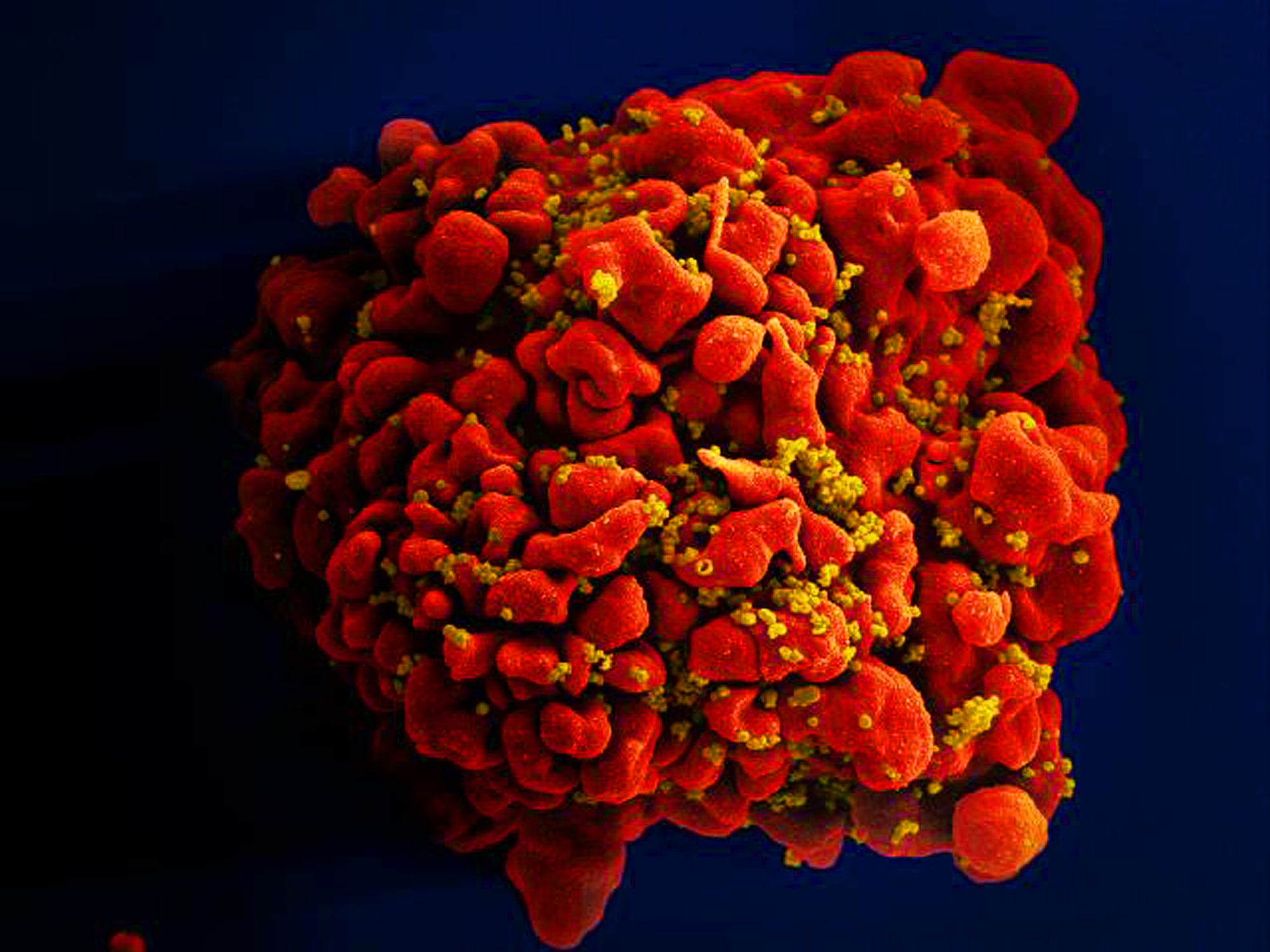 H9-T cell infected by HIV