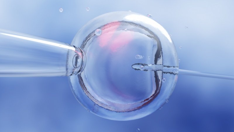 IVF in vitro fertilization
