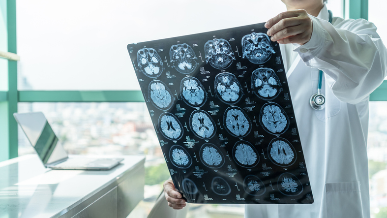 A neurologist reviews brain scans