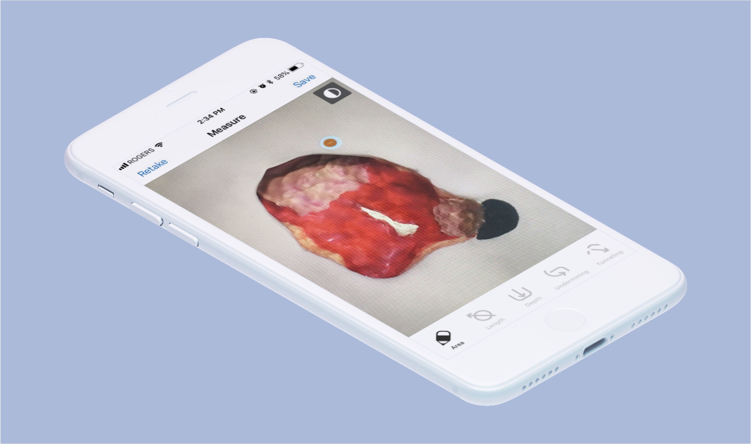 smartphone with screenshot of camera view of patient wound