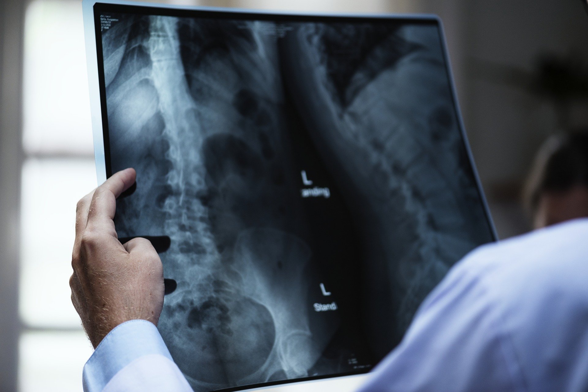 Radiology xray doctor diagnostics testing