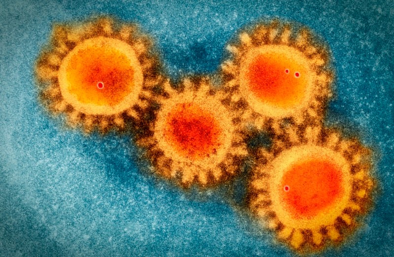Coronavirus Sars-CoV-2 under an electron microscope