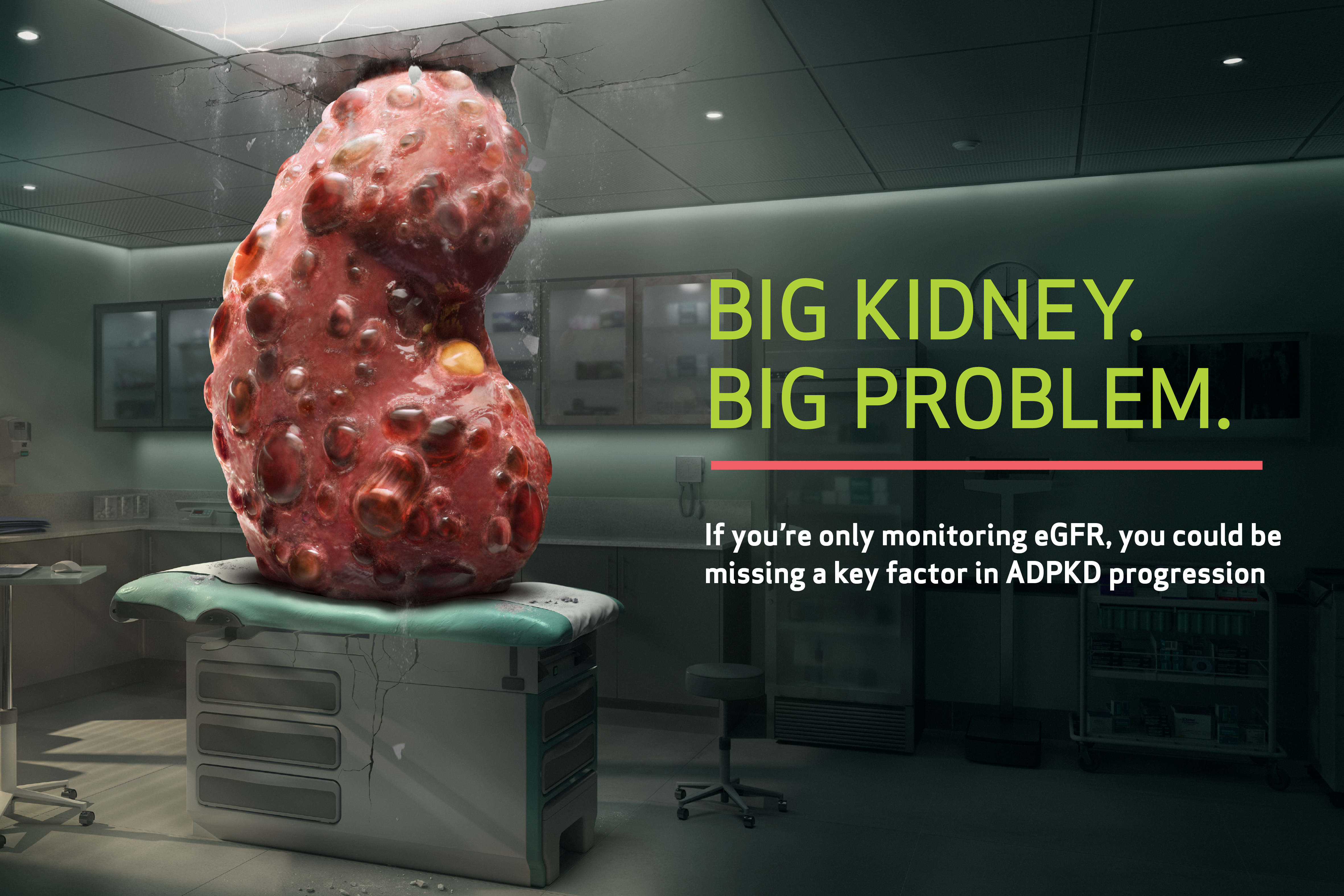 Otsuka Big Kidney Big Trouble campaign website image 