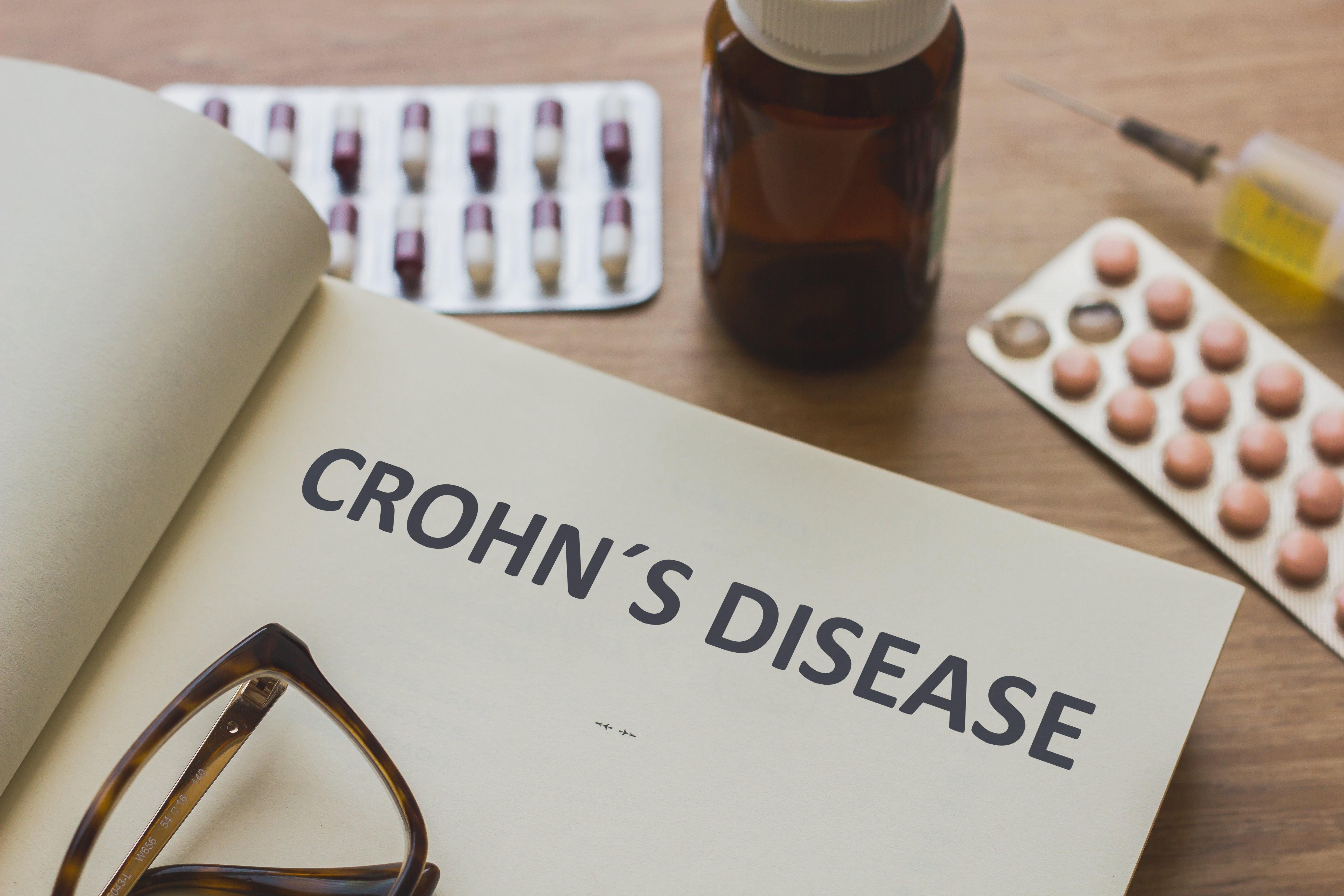 Crohns disease stock photo