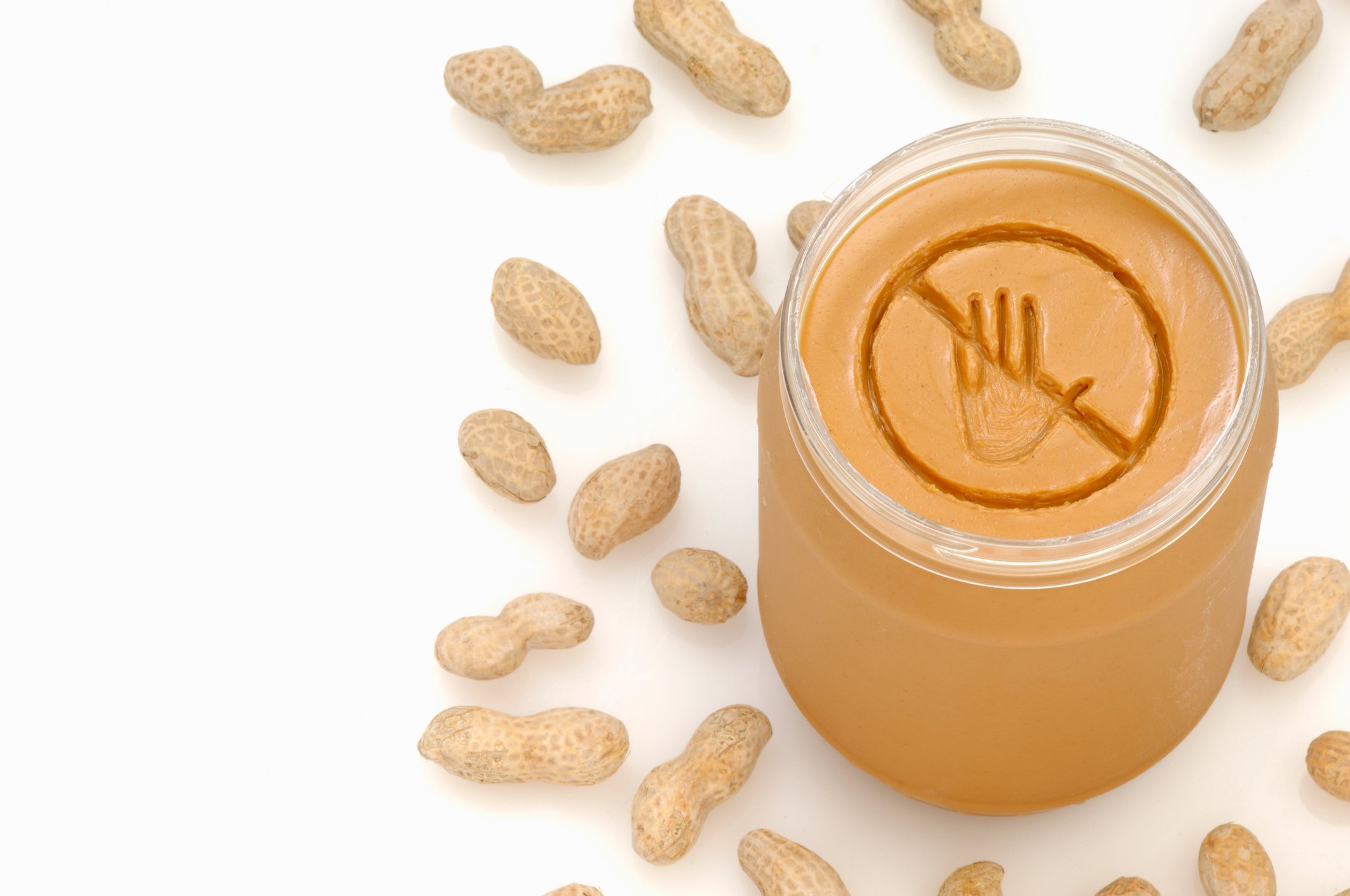 Getty Image picture of peanut butter and nuts to show allergy