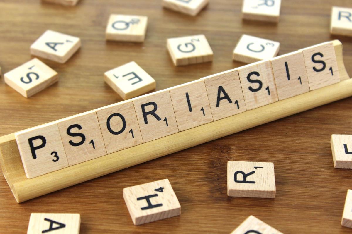 scrabble tiles spelling out psoriasis
