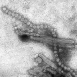An electron micrograph of influenza A H7N9--CDC image (public domain)