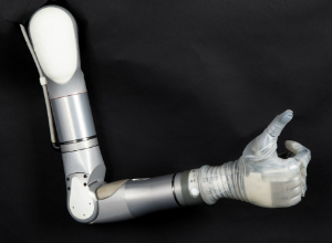 a prosthetic arm