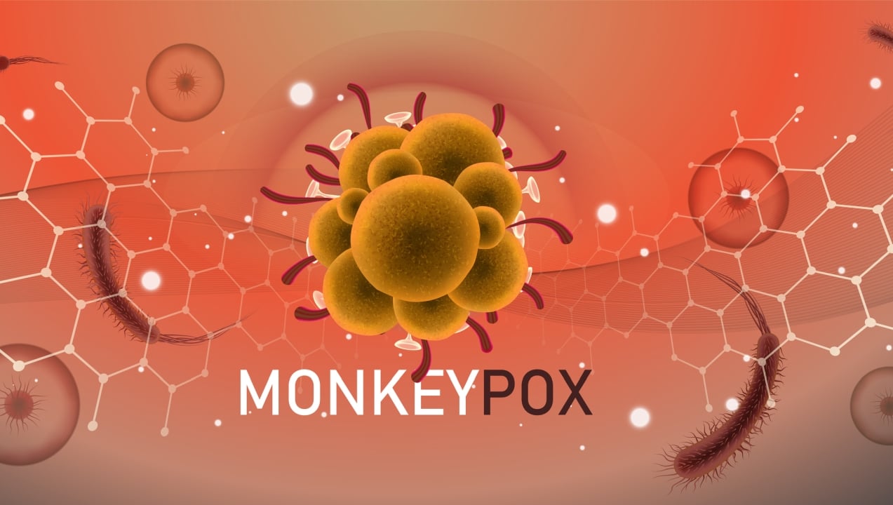 Monkeypox outbreak won't be the next COVID