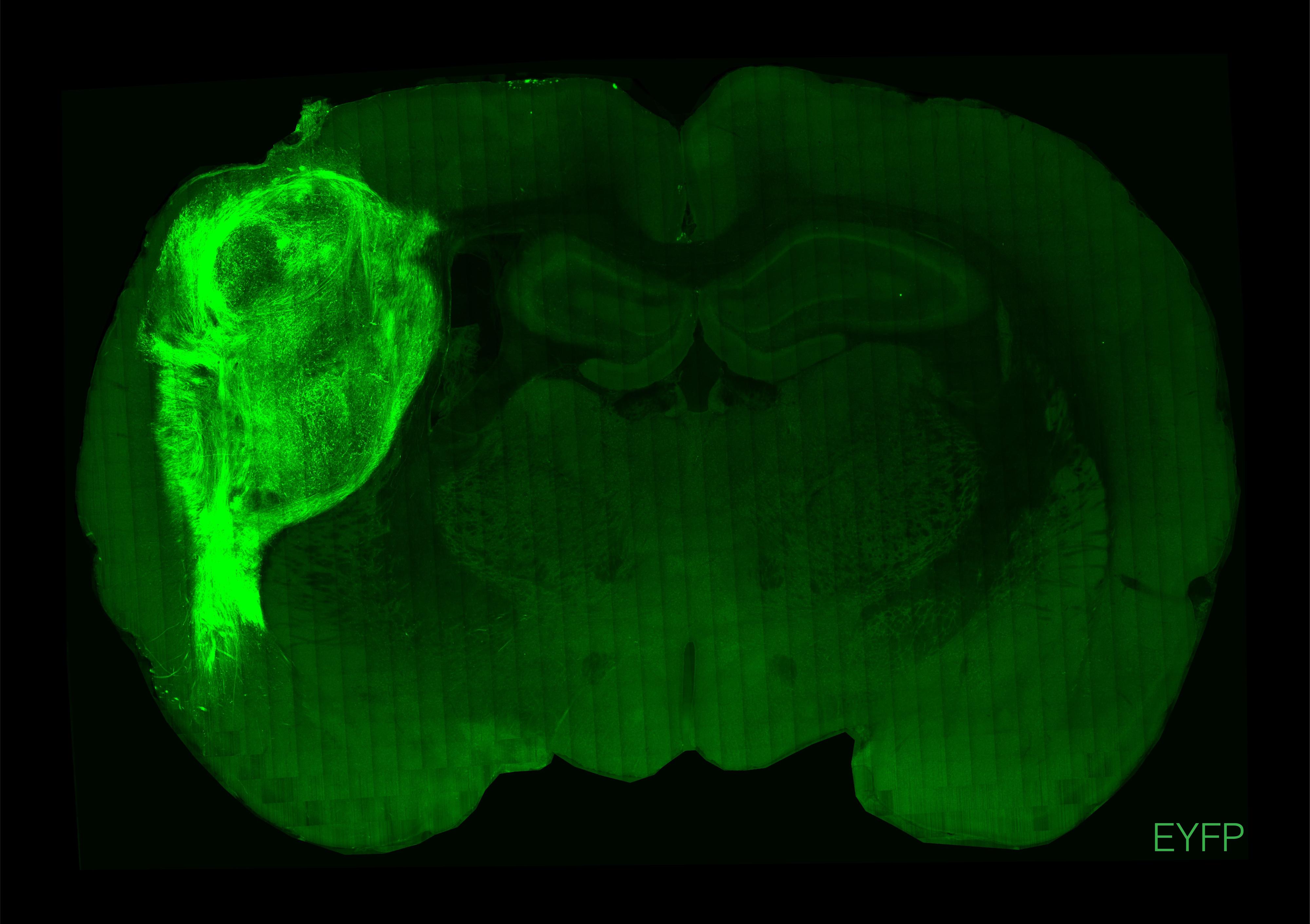 This image shows a cross section of a rat brain taken from one of the experimental rats  The whole brain is green but the 