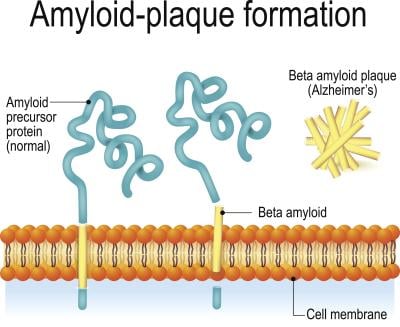 amyloid-plaque formation