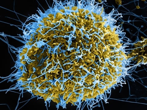 Colorized scanning electron micrograph of filamentous Ebola virus particles budding from a chronically infected VERO E6 cell