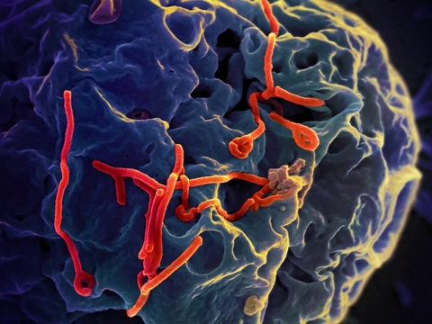 Electron micrograph showing Ebolavirus budding from the surface of a Vero cell from the African green-monkey kidney epithelial cell line