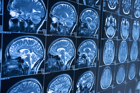 Brain imaging